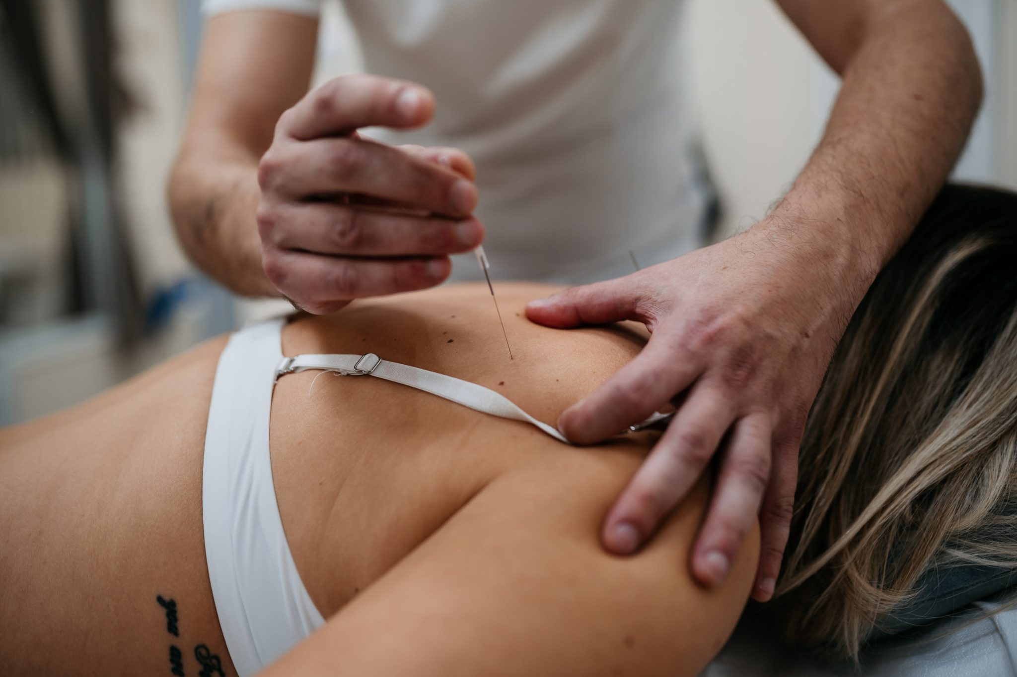 Elektro akupunktura